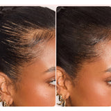 Thinning & Gaps